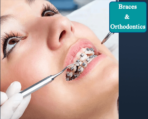 Braces & Orthodontics